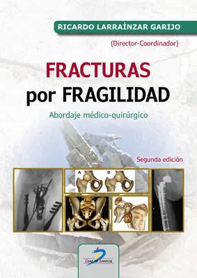 Fracturas por Fragilidad