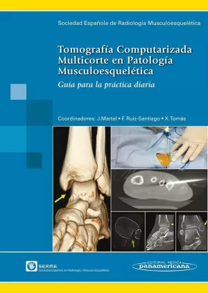 Tomografia Computarizada Multicorte en Patologia Musculoesqu